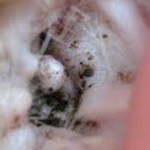 猫の耳の中に黒い耳垢 斑点模様の黒い耳垢はダニの可能性が大 毎日のほほんねこ日和